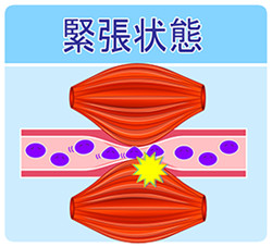 緊張状態